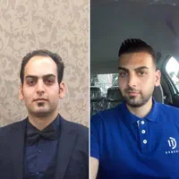 کاشت مو کاشت ابرو کاشت ریش تارکوب|خدمات آرایشگری و زیبایی|هشتگرد, |دیوار