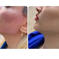 زاویه سازی و مدلینگ صورت