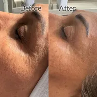 پاکسازی و فیشال تخصصی مشاوره رایگان|خدمات آرایشگری و زیبایی|تهران, حکمت|دیوار
