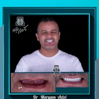 خدمات ترمیم دندان ،مطمین ترین تکنیک های دندانپزشکی|خدمات آرایشگری و زیبایی|شیراز, معالی‌آباد|دیوار
