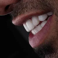 دندانپزشکی نقد و اقساط باتخفیفات بینظیر دندانپزشکی