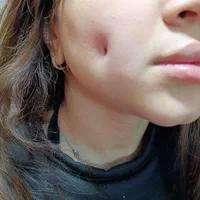 خدمات پرسینگ ومیکرودرمال وچال گونه دائم|خدمات آرایشگری و زیبایی|مشهد, شهید معقول|دیوار