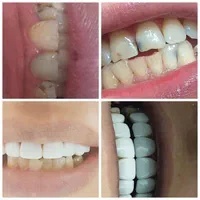 دنتال لند|خدمات آرایشگری و زیبایی|کرمانشاه, |دیوار