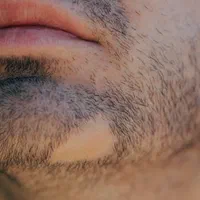 کلینیک زیبایی خیابان ادب|خدمات آرایشگری و زیبایی|سنندج, |دیوار