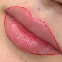 ژل،بوتاکس، لیزرخال و تاتو،ریمور|خدمات آرایشگری و زیبایی|قم, نیروگاه|دیوار