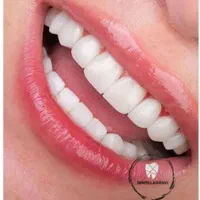 آموزش دندانپزشکی و کامپوزیت . لمینت .ترمیم|خدمات آموزشی|اسلام‌شهر, |دیوار