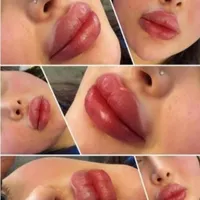ژل و بوتاکس و مزو سر و صورت|خدمات آرایشگری و زیبایی|کوهدشت, |دیوار