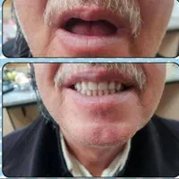 ساخت پروتزدندان مصنوعی لابراتواردندانسازی باضمانت|خدمات آرایشگری و زیبایی|فردیس, منظریه|دیوار