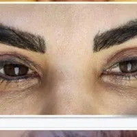 جشنواره بلفارو پلاستی چشم گربه ای جراحی پلک|خدمات آرایشگری و زیبایی|اصفهان, مسجد مصلی|دیوار