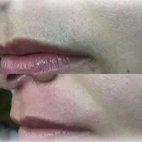 لیزر صورت و بدن آقایان و بانوان در کلینیک|خدمات آرایشگری و زیبایی|پرند, فاز ۲|دیوار