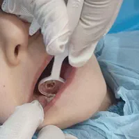 دندانپزشکی اطفال کودک‌ و نوجوان فردیس کرج