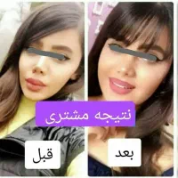 دخترا فروزان رو‌ب اتمام|آرایشی، بهداشتی، درمانی|تهران, هروی|دیوار
