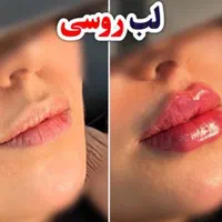 آموزش و خدمات تخصصی فیلر بادی(مطب)