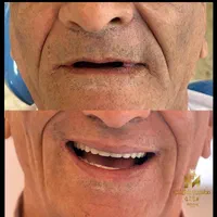 دندانسازی رویال (مرادلو)|خدمات آرایشگری و زیبایی|تهران, قنات‌کوثر|دیوار