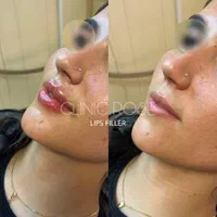 کلینیک زیبایی ژل و فیلر،بوتاکس و لیزر،جراحی پلک