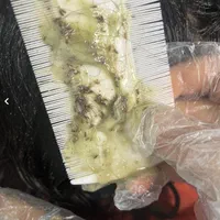 درمان شپش دستگاه ومحلول