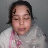 بابیمه تکمیلی حجامت، بادکش فصد،بوتاکس زالو سیاتیک|خدمات آرایشگری و زیبایی|اصفهان, وحید|دیوار