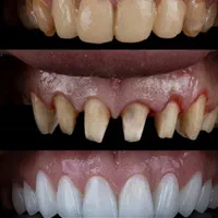 خدمات دندانپزشکی در مطب خصوصی با دو سال ضمانت