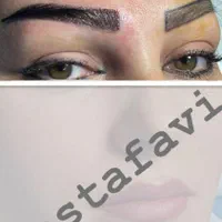 کاشت مو و ابرو با بروز ترین متد کاشت (تبریز)|خدمات آرایشگری و زیبایی|زنجان, |دیوار