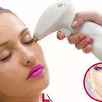 لیزرمو زائدآقایان.بانوان.خال برداری.پاک تاتو.کربن