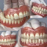 کلینیک دندانسازی ساخت دندان مصنوعی تضمینی|آرایشی، بهداشتی، درمانی|شهریار, |دیوار