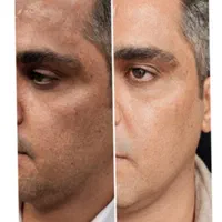 کلینیک لیزر و زیبایی دکتر اکرم درویش زاده|خدمات آرایشگری و زیبایی|زاهدان, |دیوار