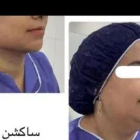 اموزش پزشک متخصص ژل.فیلر‌بوتاکس.لیفت نخ.ساکشن غبغب|خدمات آموزشی|مشهد, سناباد|دیوار