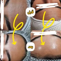 مدل فیشال فقط هزینه مواد، ظرفیت محدود