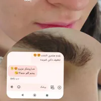 فیشیال تخصصی پوست|خدمات آرایشگری و زیبایی|گلبهار, |دیوار