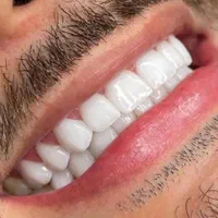 دندانسازی سینا ساخت دندان مصنوعی سازی متحرک و نرم|خدمات آرایشگری و زیبایی|شیراز, سینما سعدی|دیوار