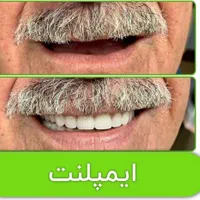 مرکز تخصصی ایمپلنت، مطب دندانپزشکی باقیمتی کم نظیر|خدمات آرایشگری و زیبایی|شیراز, قصرالدشت|دیوار