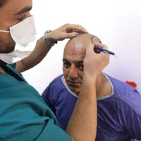 کاشت مو و ابرو تیم شیرازی در قزوین ، جشنواره اقساط|خدمات آرایشگری و زیبایی|قزوین, |دیوار
