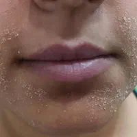 خدمات و‌آموزش فیشال،کربوکسی،میکرونیدلینگ و پلاژن|خدمات آرایشگری و زیبایی|اهواز, پادادشهر|دیوار