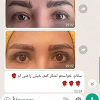 جشنواره جراحی پلک بالا در کلینیک تخصصی اورانوس|خدمات آرایشگری و زیبایی|تهران, جنت‌آباد جنوبی|دیوار
