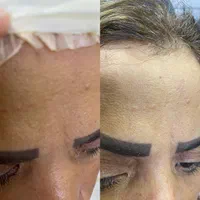 خدمات وآموزش پاکسازی پوست فیشیال فقط ویژه بانوان|خدمات آرایشگری و زیبایی|مشهد, طلاب|دیوار