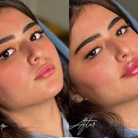 آموزش و انجام خدمات پوست و مو ژل و بوتاکس و..|خدمات آرایشگری و زیبایی|نور, |دیوار