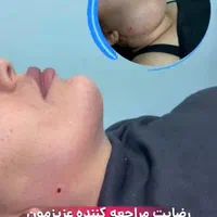 تزریق چربی فیلربادی تزریق ژل در مطب پزشک|خدمات آرایشگری و زیبایی|کرمانشاه, |دیوار