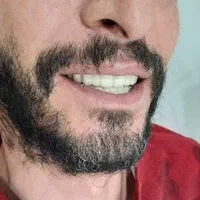 خدمات دندانسازی و دندانپزشکی|خدمات آرایشگری و زیبایی|ارومیه, |دیوار