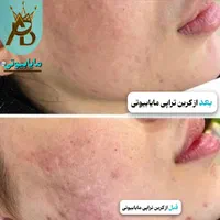 اولین مرکز روشن کننده بیکینی و زیربغل،مایابیوتی