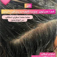 آموزش تخصصی کرم پودرفشیال مزونیدل اسکالپ سر وخدمات|خدمات آرایشگری و زیبایی|مشهد, جانباز|دیوار