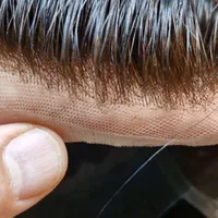 پروتز مو با روش میکروپانچ