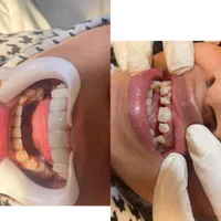 دندانسازی|خدمات آرایشگری و زیبایی|اهواز, کیانپارس |دیوار