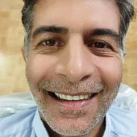 دندانسازی،دندان مصنوعی،جوان پسند،اقساطی با چک|خدمات آرایشگری و زیبایی|مشهد, شاهد (شهرک غرب)|دیوار