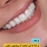 کلینیک دندانپزشکی ایمپلنت ارتودنسی زیبایی درمانی|خدمات آرایشگری و زیبایی|تبریز, |دیوار