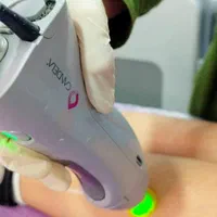 لیزر موی زائد الکس کندلا آمریکایی 2022 (شوش)|خدمات آرایشگری و زیبایی|شوش, |دیوار