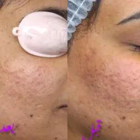مطب پوست ،لیزر ،لاغری