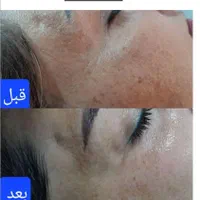 فیشیال تخصصی بانوان و آقایان و آموزش|خدمات آرایشگری و زیبایی|شیراز, تل حسین‌آباد|دیوار