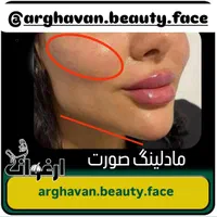 ژل و بوتاکس و آرایش دایم|خدمات آرایشگری و زیبایی|میبد, |دیوار