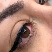 جشنواره فیبروز و میکروبلیدینگ و ریموو