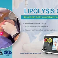 فروش دستگاه اندولیفت و اندولیزر 2024